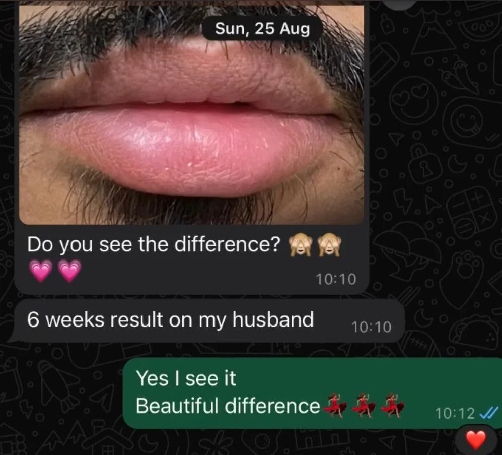 Crème Lèvre Rose (En 3 Jours)