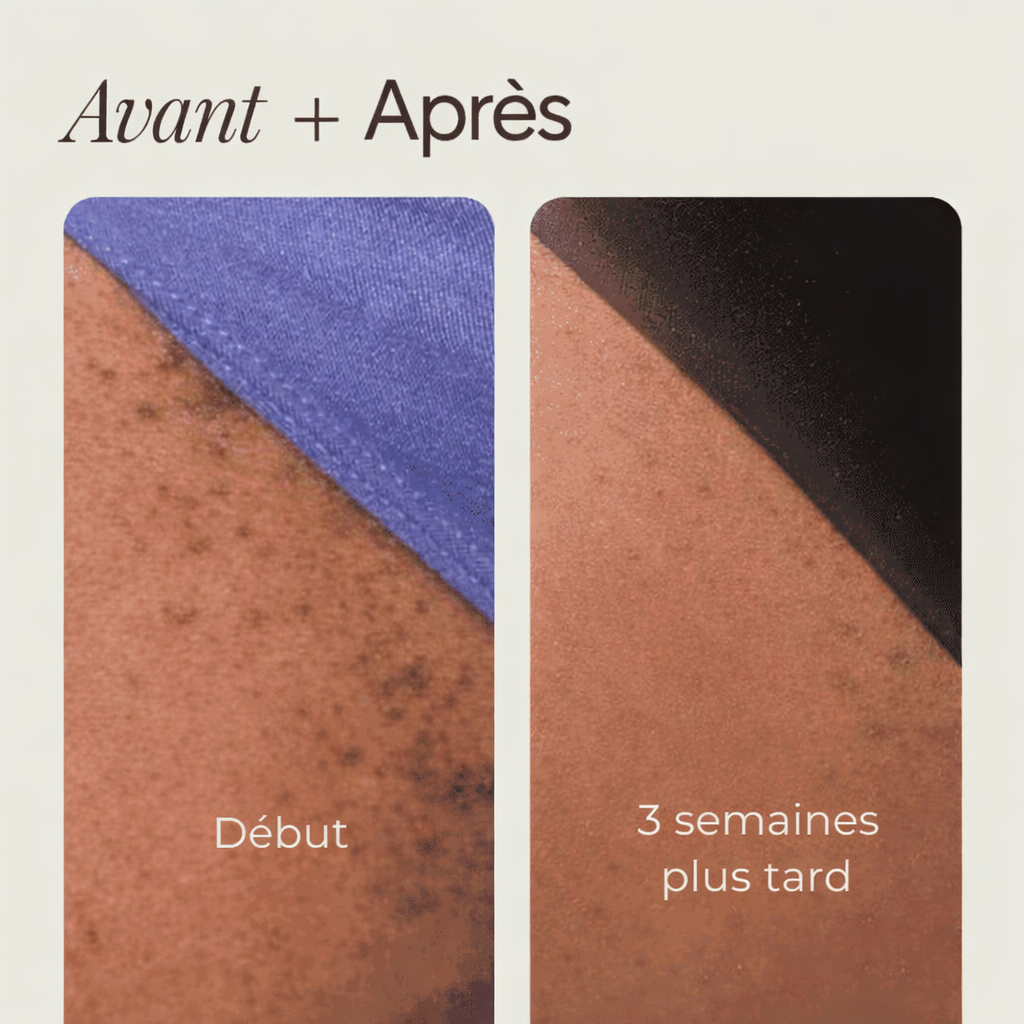 Roll-on -Solution apaisante pour l'épilation dépilatoire, lotion hydratante