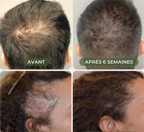 Huile de Batana pour la croissance des cheveux