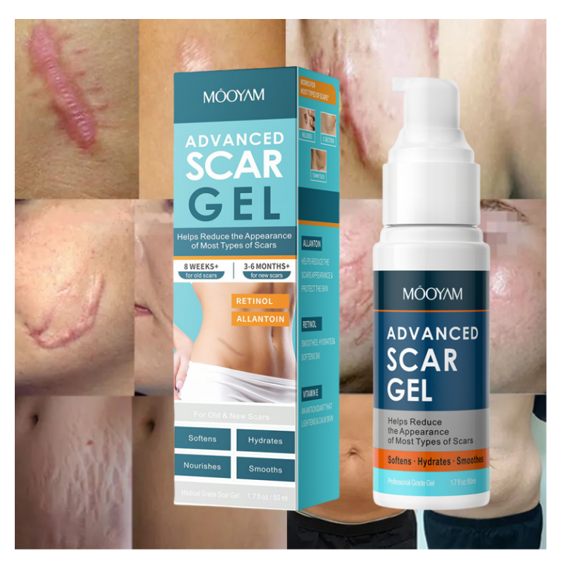 Gel Anti-Cicatrices & Vergetures MOOYAM