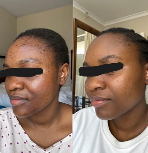 routine soin 5en 1 pour-une-peau-eclatante