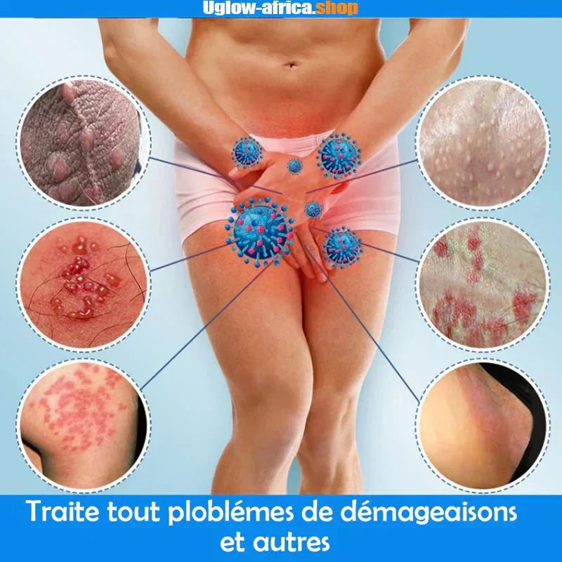 Crème anti-démangeaisons & Antibactérienne Bnn
