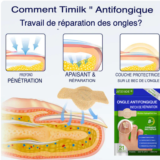SleepCure  Patch réparateur antifongique pour les ongles