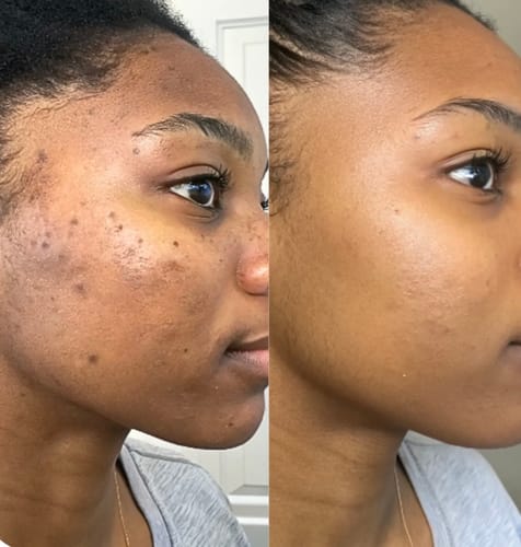 routine soin 5en 1 pour-une-peau-eclatante