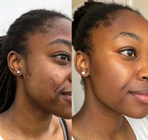 routine soin 5en 1 pour-une-peau-eclatante