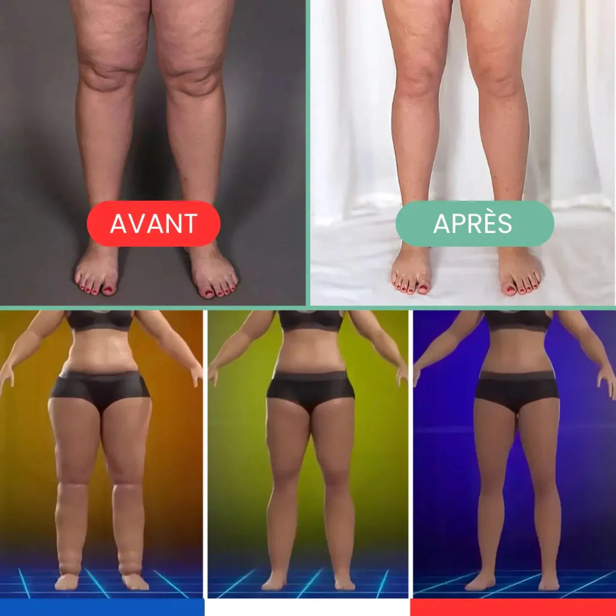 OrthoMasseur™ Thérapie 4-en-1 | Éliminer la cellulite et raffermir la peau