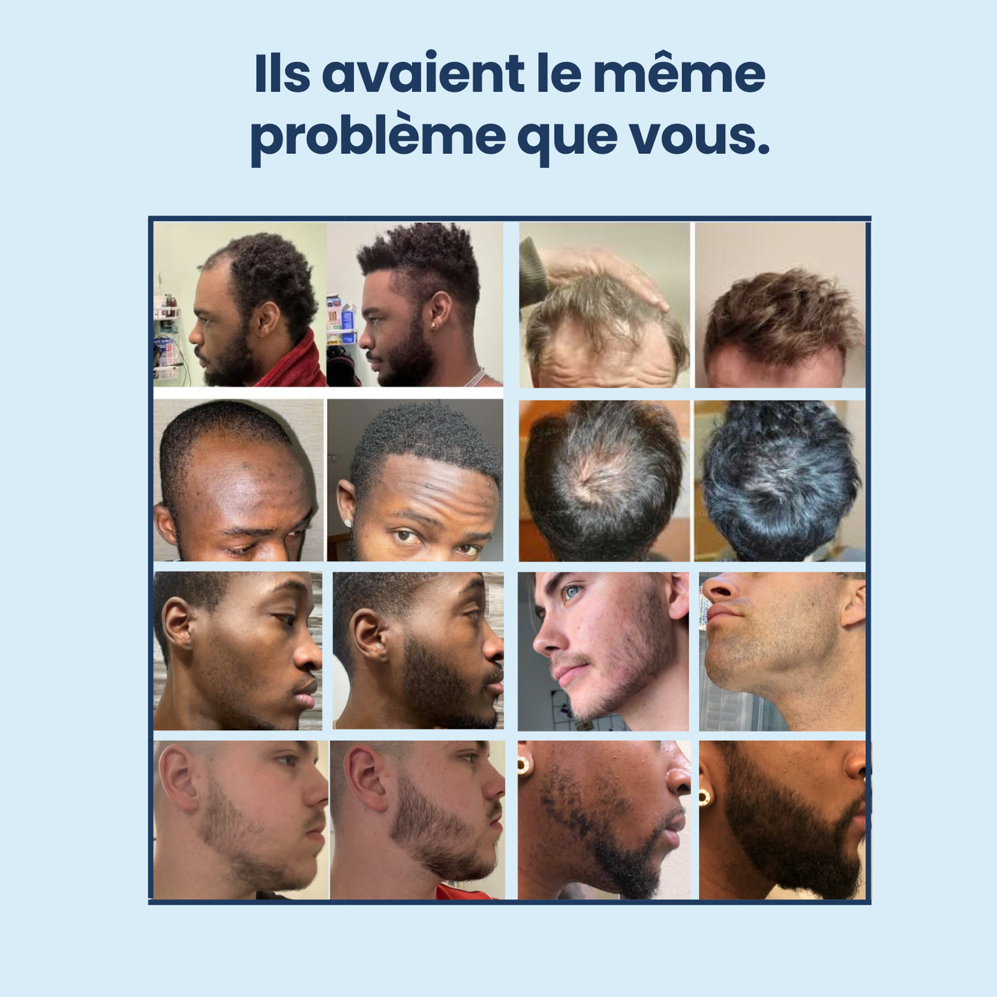 Sérum Roller Croissance+/TIKTOK