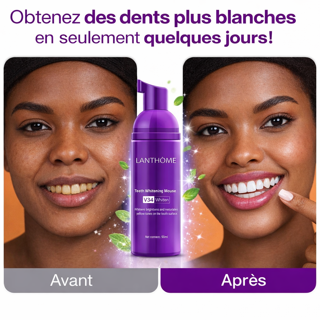 V34 Mousse Blanchiment Dentaire & Nettoyage Profond